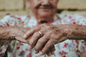 a woman with clasped hands showing sun damaged skin